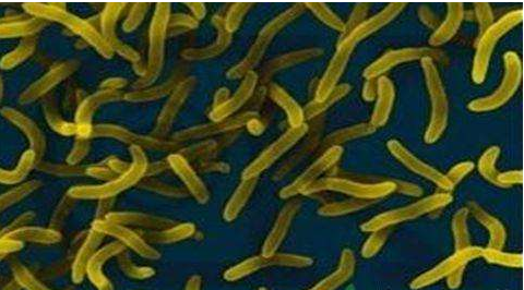 微生物菌劑好？好在哪里您知道嗎？